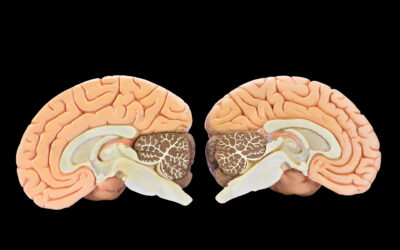 Waarom je hersenen je soms voor de gek houden… en wat dat betekent voor beleggers